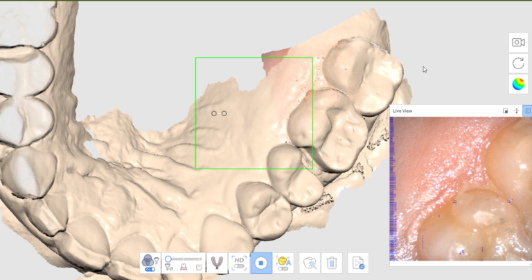 Add Live Scans To 3D Models From Any Source