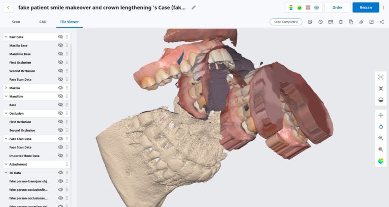 A Mix of All of the Medit Features Include Compare, Smile Design, Model Imports, CT scans, Image, Videos, etc…