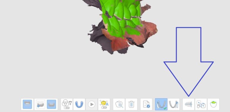 Align Occlusal Plane in Medit iScan Imaging Software- Why You Should Use It!