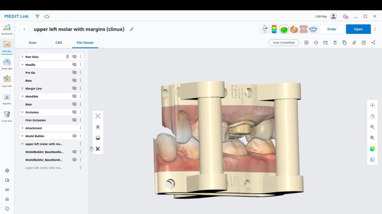 Introducing the Medit Model Builder