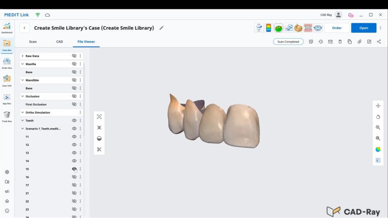 Creating Your Own Dental Morphology Library