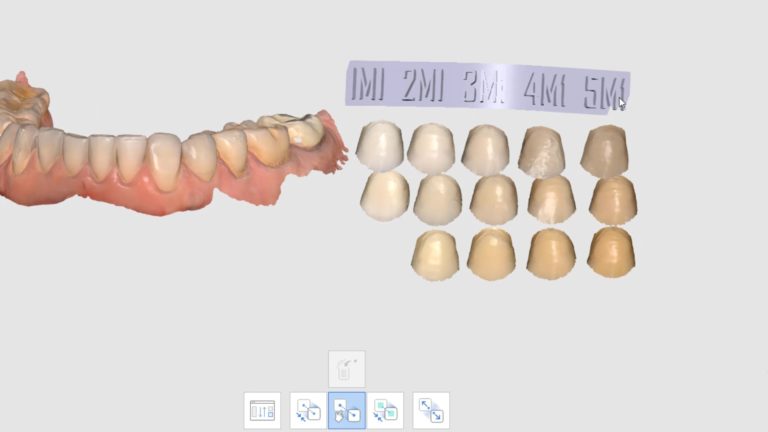 The Digital 3D Shade Guide