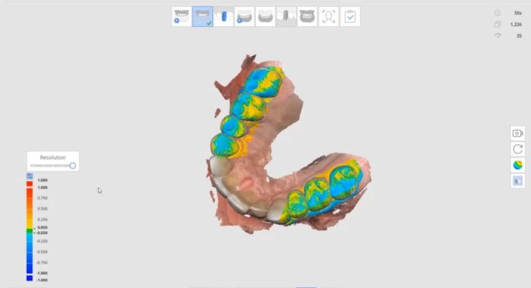 Measuring Intra-Oral Scanner Accuracy and How Accurate is the Medit Scanner?
