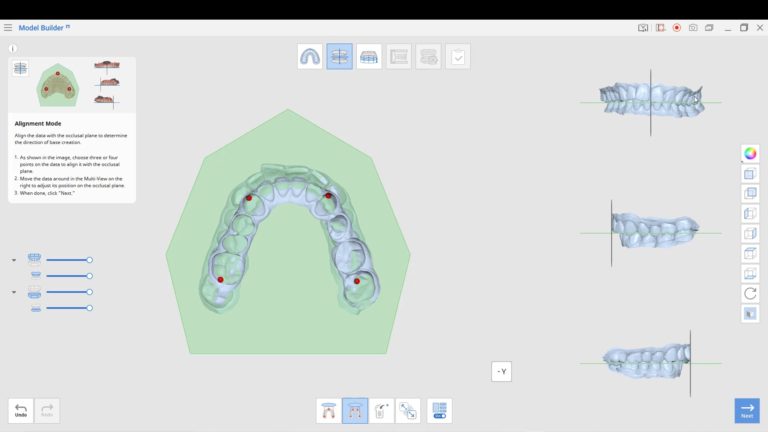 Medit’s Model Builder and Ortho Simulation Apps and the American Board of Orthodontics Electronic Cast Radiograph Evaluation (CRE)