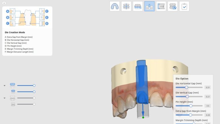 Anterior Crown Prep and Model Creator with Die
