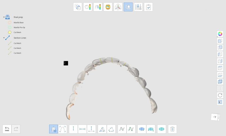 Fast and Easy Full Arch Temporary by Medit Design Software