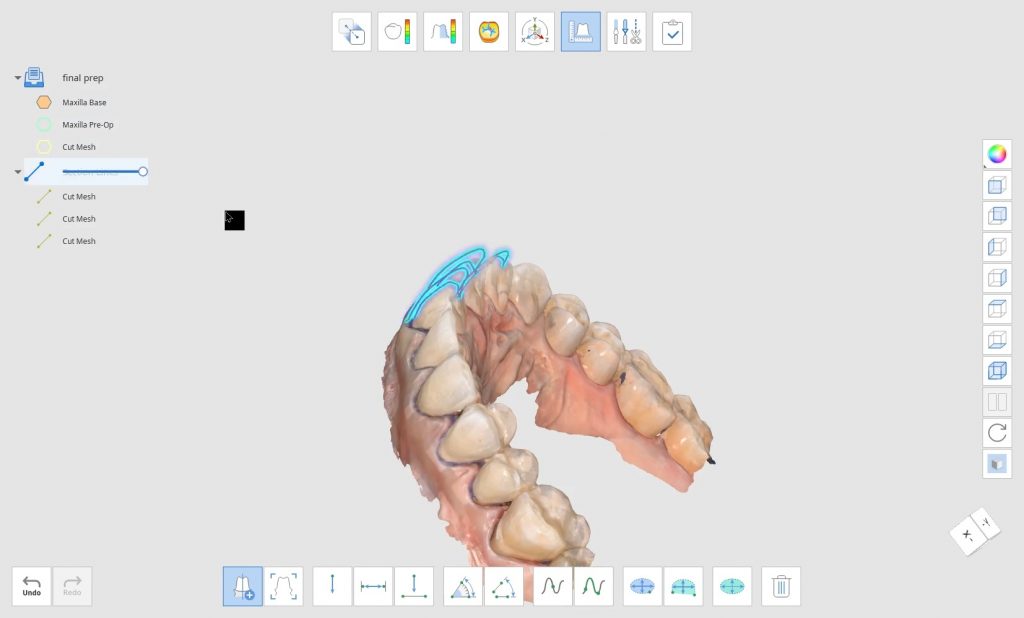 Digital Impressions Archives | CAD-Ray.com