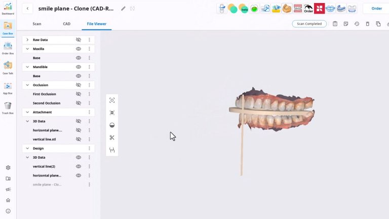 Setting Occlusal Plane and Vertical Midline in 3D
