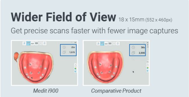 Medit i900 18 x 15 mm field of view compared with a competing scanner