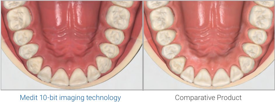 Medit iE 10-bit imaging color scan compared with a competing intraoral scanner