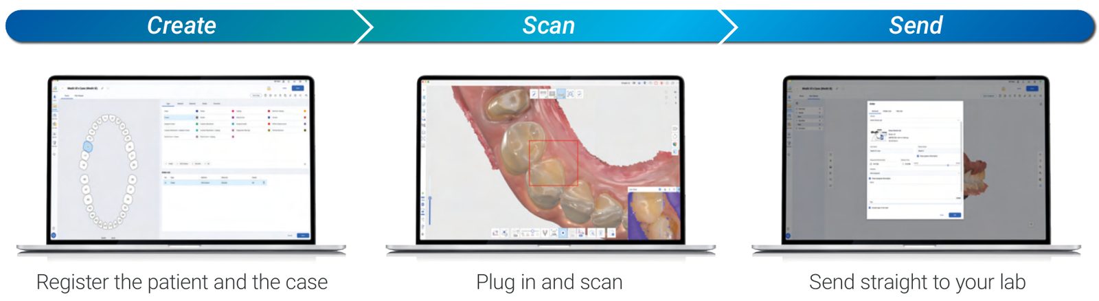 Medit iE Create, Scan, Send workflow in Medit Link