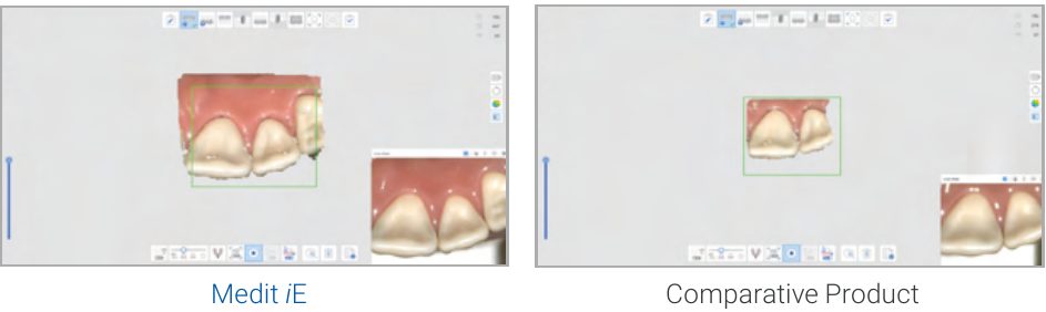 Medit iE 18 x 15 mm field of view compared with a competing intraoral scanner