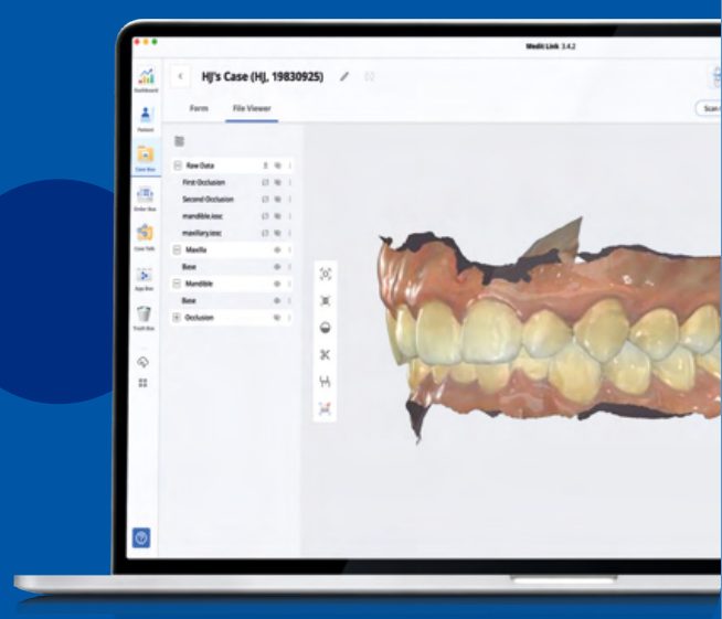 Medit Link cloud platform case management on a laptop