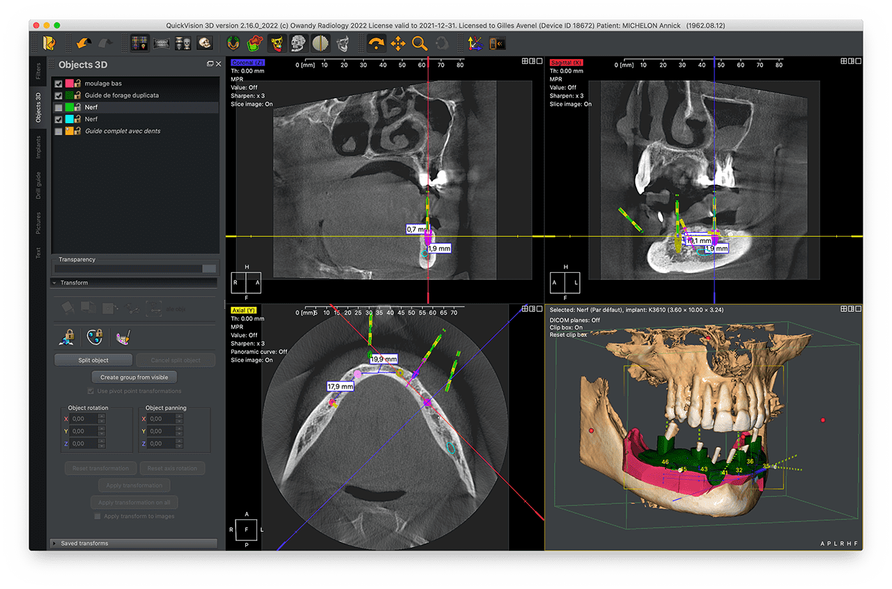 Owandy QuickVision 3D software