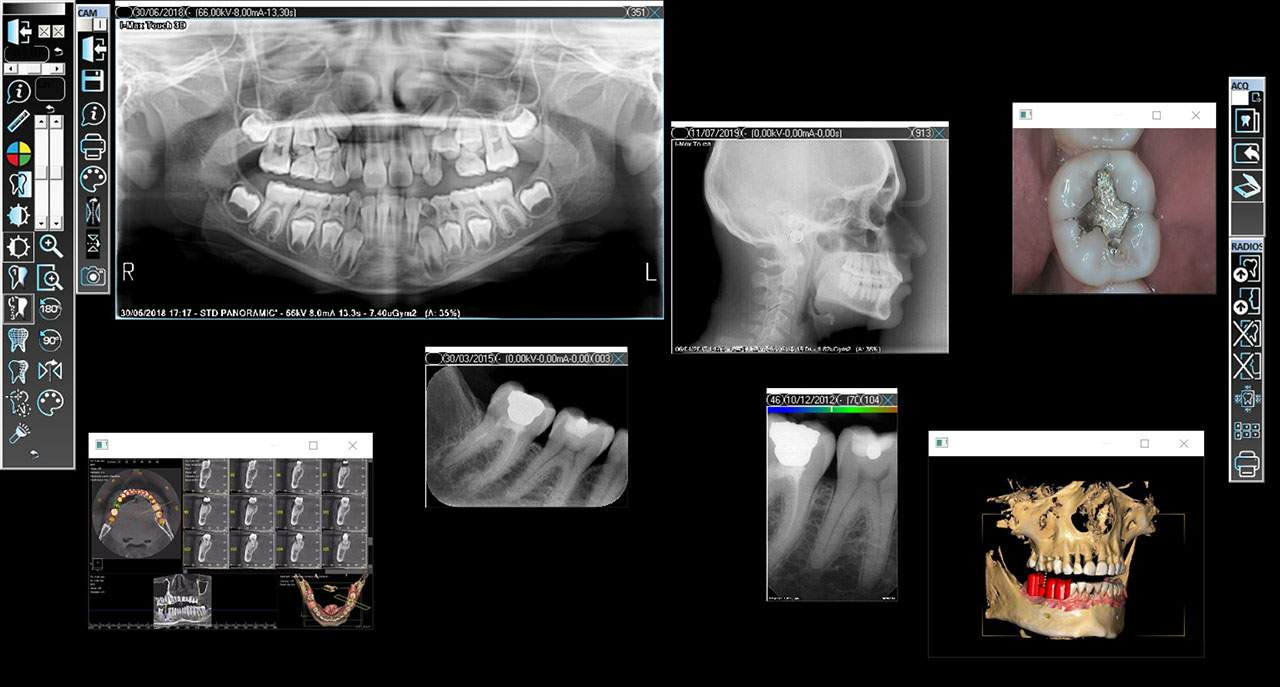 Owandy QuickVision imaging software